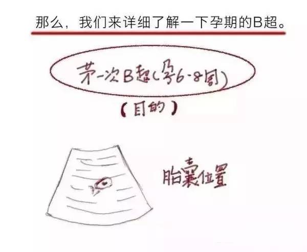 孕期b超有多牛 , 超声医生告诉你真相(手绘漫画) !