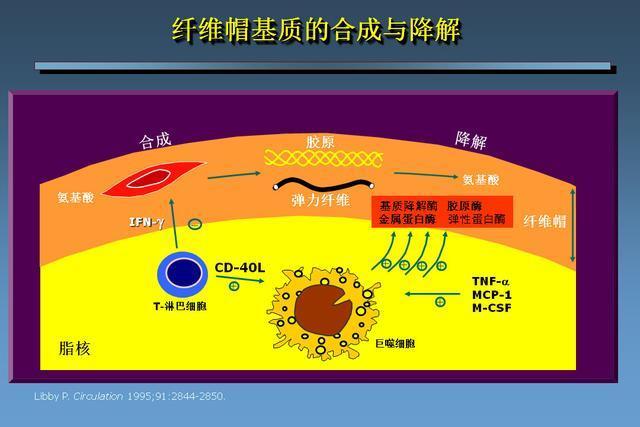 动脉粥样硬化的形成的机理