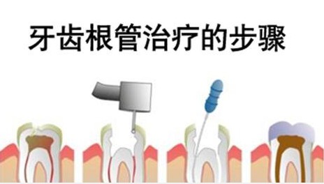 根管治疗 给牙齿换个 芯