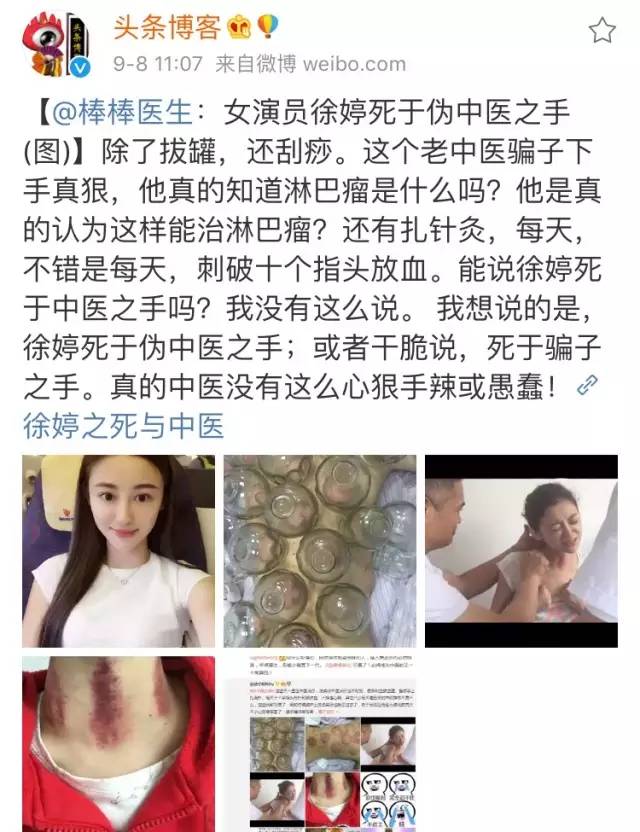 疼爱！90后女星徐婷病逝，得知癌症后我竟然有一丝