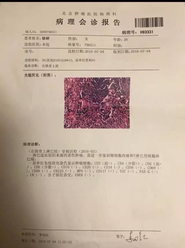 疼爱！90后女星徐婷病逝，得知癌症后我竟然有一丝