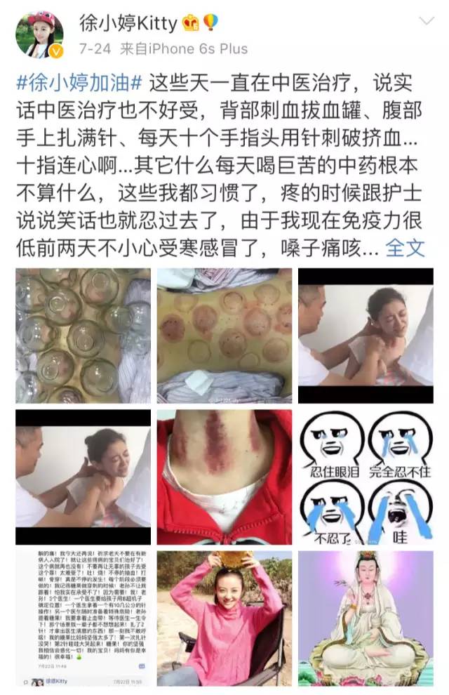 疼爱！90后女星徐婷病逝，得知癌症后我竟然有一丝