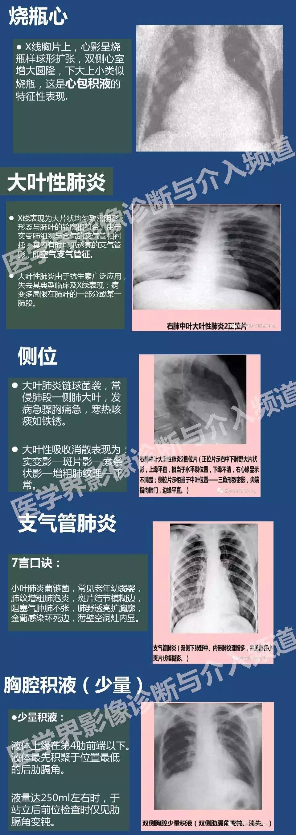 再读不懂胸片别说你是我教的啊