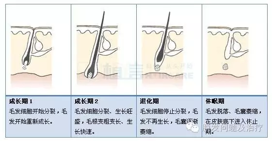 为何他人的脱发三个月就好？而你却重复的脱落