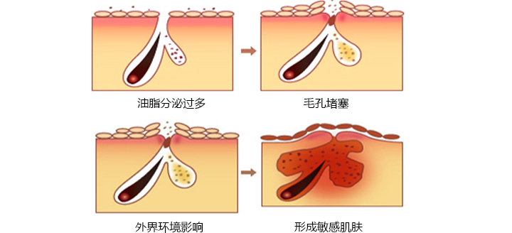 要想美丽动人,离不开皮肤健康_健康_南阳新闻