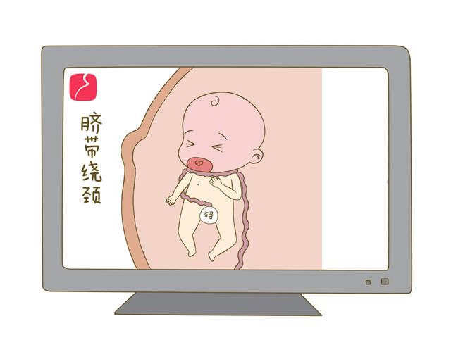 走近胎宝宝之脐带异常篇