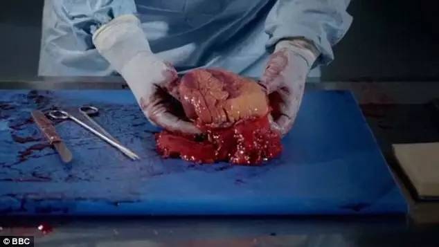 BBC解剖了一个胖子遗体拍成了纪录片.看完还