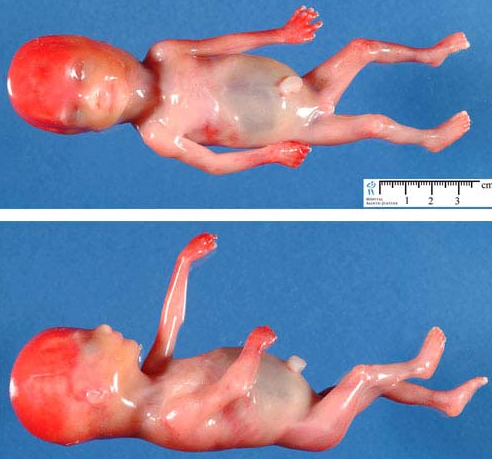 20周胎儿图