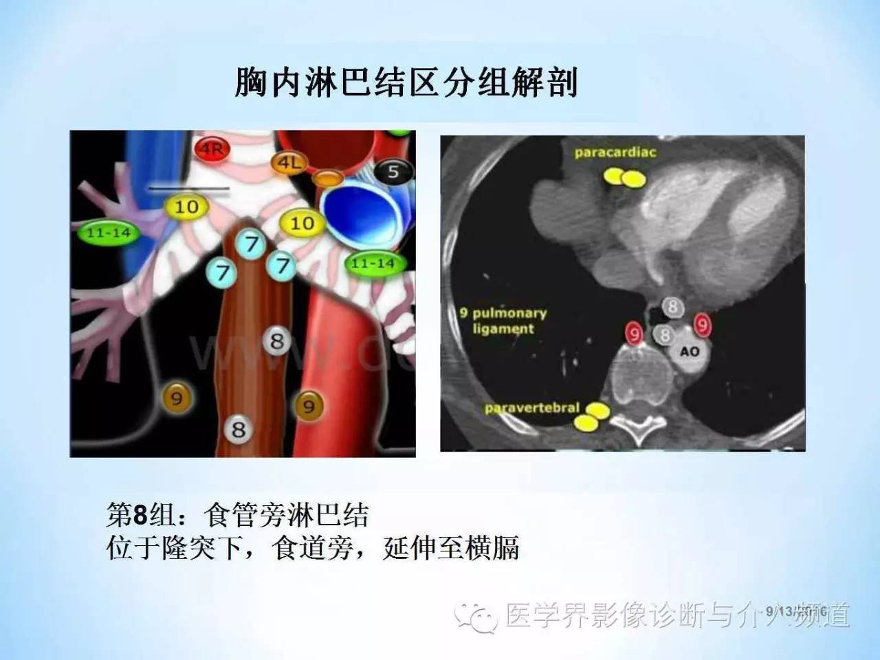 肺部及胸内淋巴结分组解剖超全