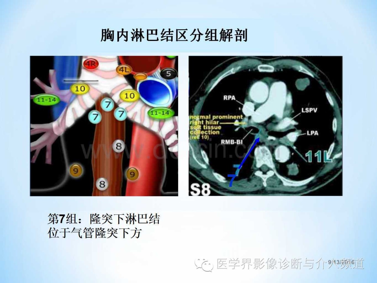 肺部及胸内淋巴结分组解剖超全