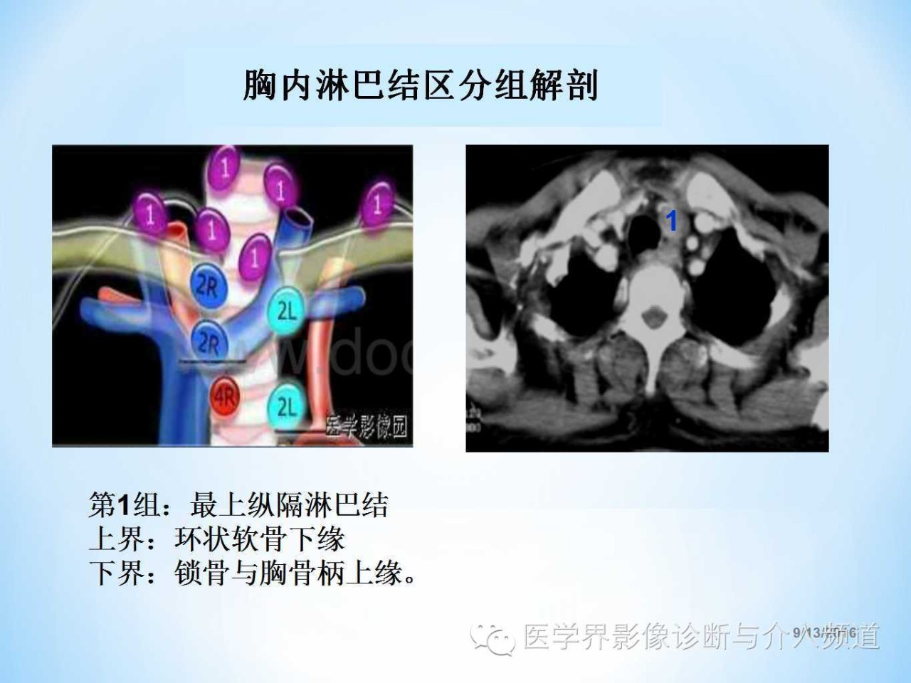 肺部及胸内淋巴结分组解剖超全