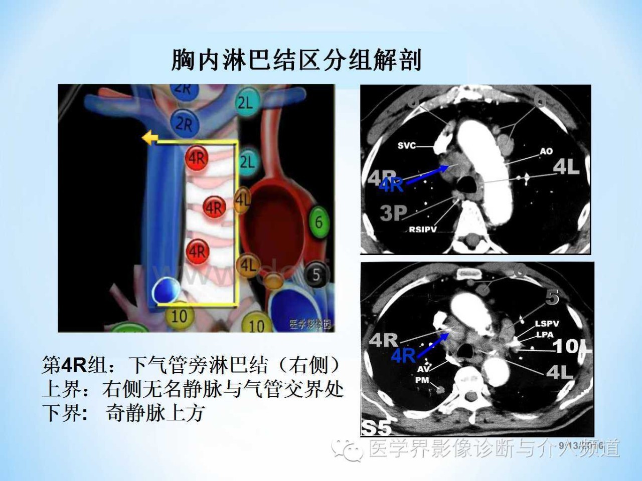 肺部及胸内淋巴结分组解剖超全