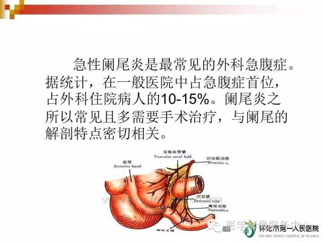 急性阑尾炎的ct诊断简单易懂