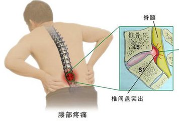 人口手足教案_感情上注重物质,烂桃花多的几种手相