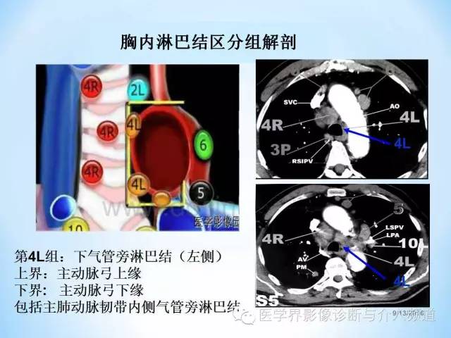 肺部及胸内淋巴结分组解剖,超全!