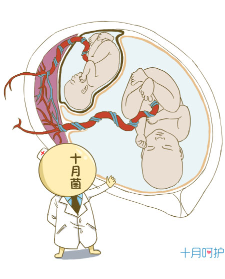 孕期  有的孕妈通过b超检查发现自己怀的是双胞胎,但是之后检查却发现