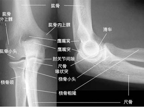 肘关节滑膜炎的表现症状有哪些,有知道的吗?