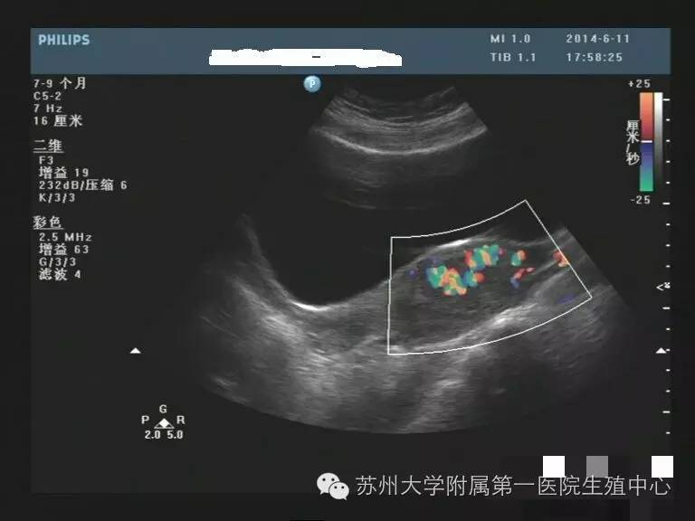 超声检查知多少(上篇)