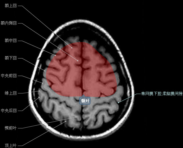 大集合!颅脑轴向结构解剖图