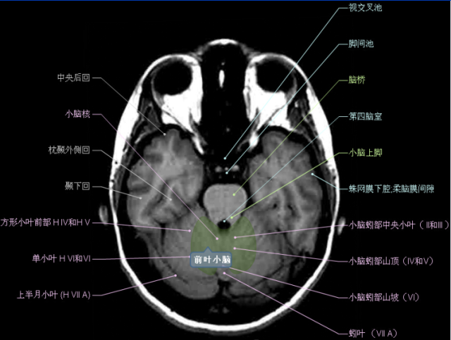 大集合颅脑轴向结构解剖图