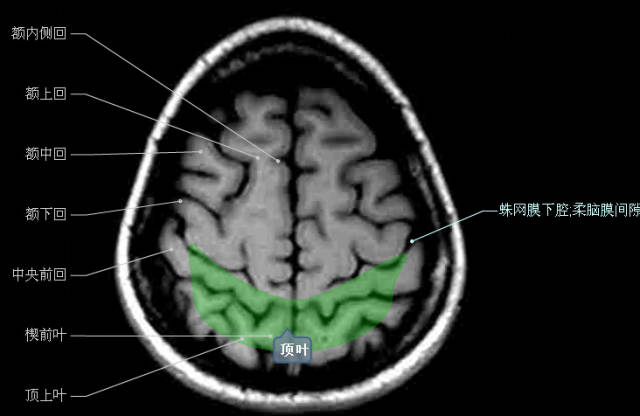 大集合颅脑轴向结构解剖图