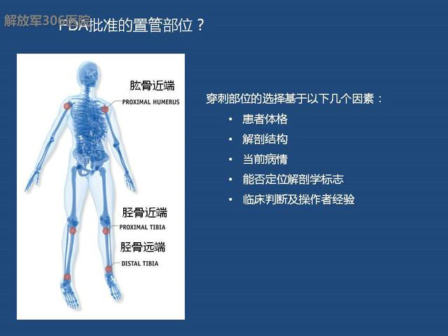 新型急救方法-骨髓腔急救输液系统