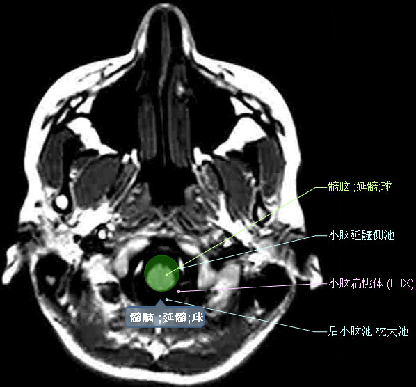 颅脑轴向结构解剖图