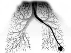 健康讲堂丨体检发现肺部小结节该怎么办?