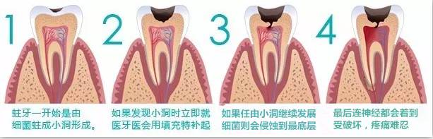 牙周病