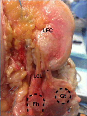 右膝关节外侧面观,*为前外侧韧带,lfc-股骨外侧髁,lcl-外侧副韧带,fh