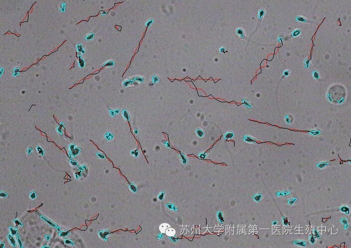 液化情况,酸碱度,精子浓度,活动率,存活率,运动速度和运动轨迹特征的