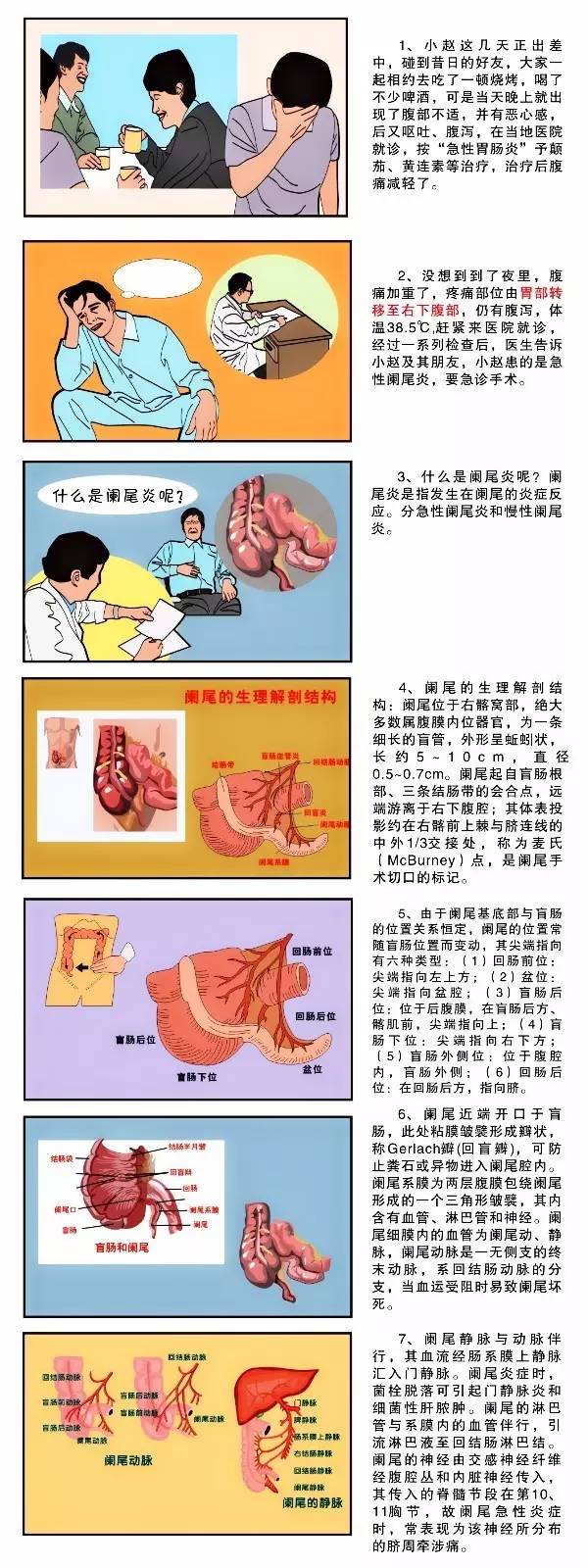 图解疾病:阑尾炎