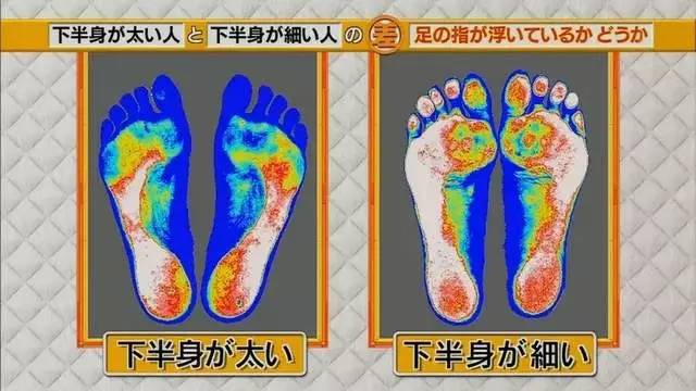 瘦腿贴原理是什么_瘦腿针原理图片(2)