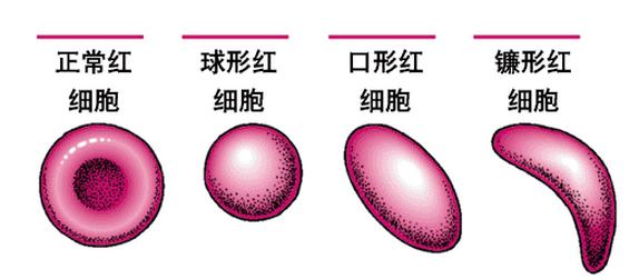 教你看懂血常规!(二)