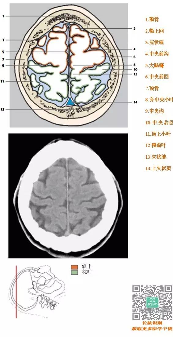 一套非常牛的「头颅ct解剖图谱」