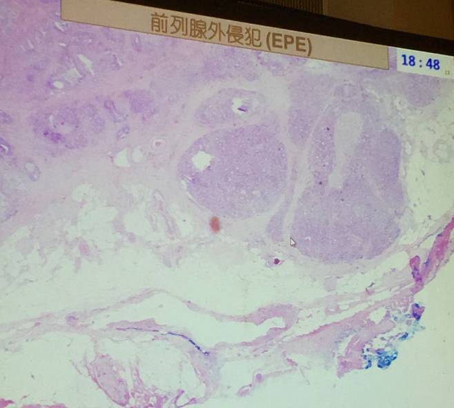 医生们病理报告背后的故事你们知道吗