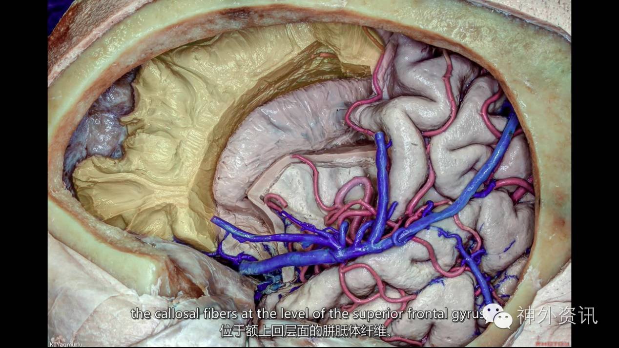 大脑纤维传导通路therhotoncollection系列解剖视频