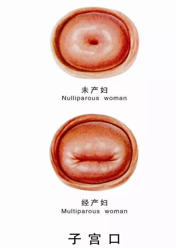 没有生育过的宫颈口就是这样的——