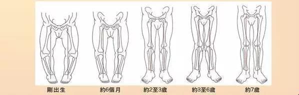 家长可以自测孩子是否是o型腿或x型腿.