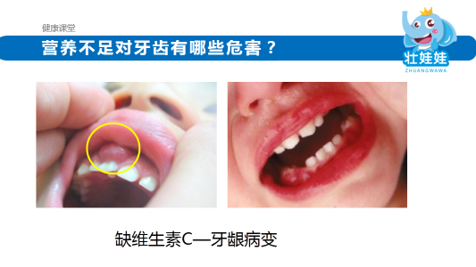 茁壮牙齿的食疗秘方