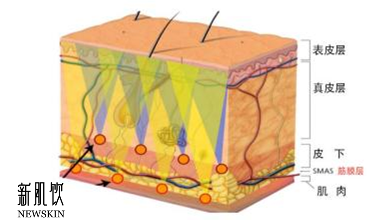纳米修复型胶原蛋白新肌饮修复smas筋膜层