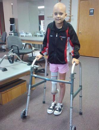 女孩因癌症右小腿截肢后没被打败,反而创造出奇迹