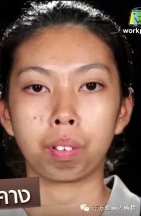 现实版丑女大翻身龅牙女改头换面在泰国引轰动