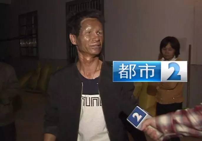 南昌3名幼童被炸得一脸焦黑惨不忍睹 赶紧扔掉这玩具!