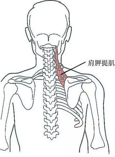 肩胛提肌压痛点肩胛提肌起始于上4个颈椎横突,抵止于肩胛骨内侧角.