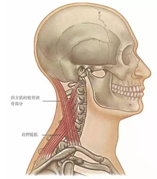 压痛部位:肩胛提肌,上斜方肌,中斜角肌,冈下肌   因张先生右侧肩膀