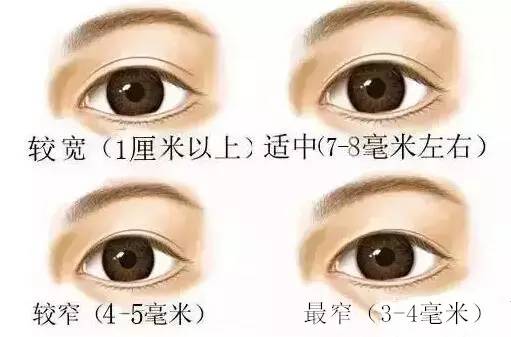 五种丨双眼皮形态设计