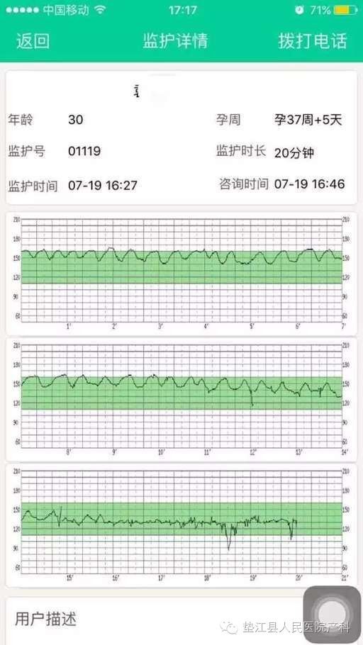 孕妇于16:46分在家上传胎心监护图,疑似正弦波,医生怀疑胎儿宫内窘迫