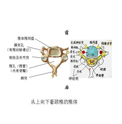 交感神经型颈椎病怎么治疗?