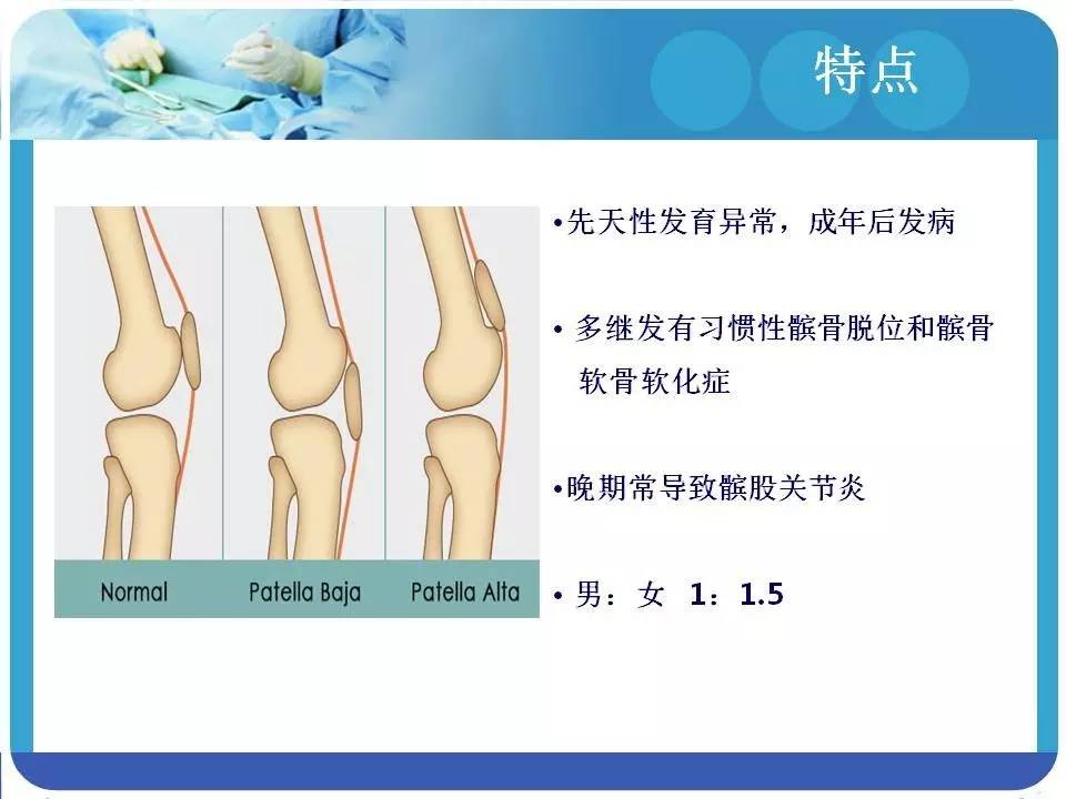 精彩幻灯:高位髌骨的诊断和治疗